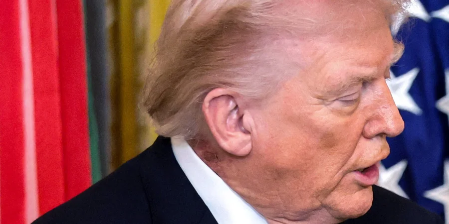 На що хворіє Трамп? Фізіотерапевт висунув нові припущення про стан президента США фото 5
