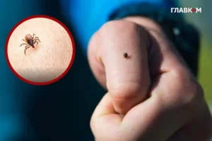 Кліщ у дитини: лікарка з Києва дала поради батькам