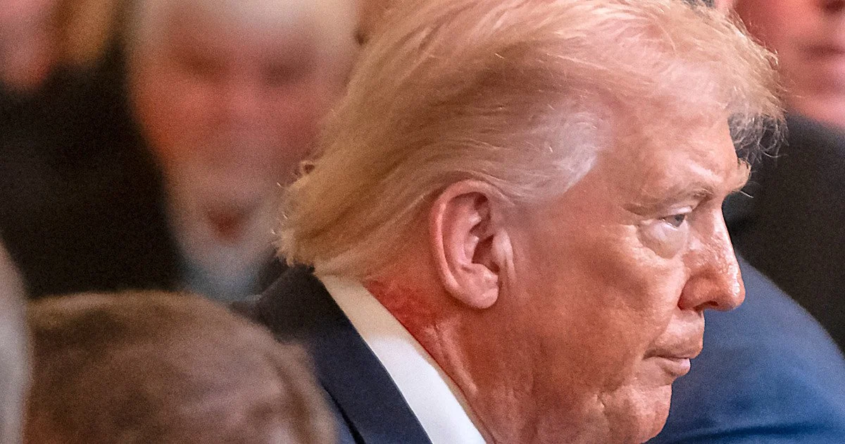 На що хворіє Трамп? Фізіотерапевт висунув нові припущення про стан президента США фото 4