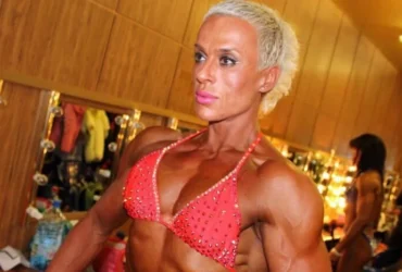 Російська чемпіонка світу з фітнесу впала в кому під час операції зі збільшення грудей