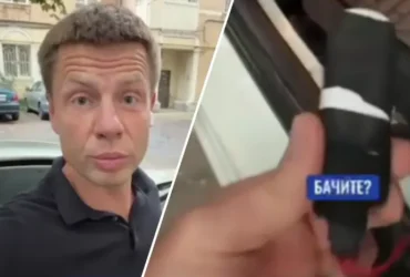 Нардеп Гончаренко заявив, що знайшов прослуховувальний пристрій в авто