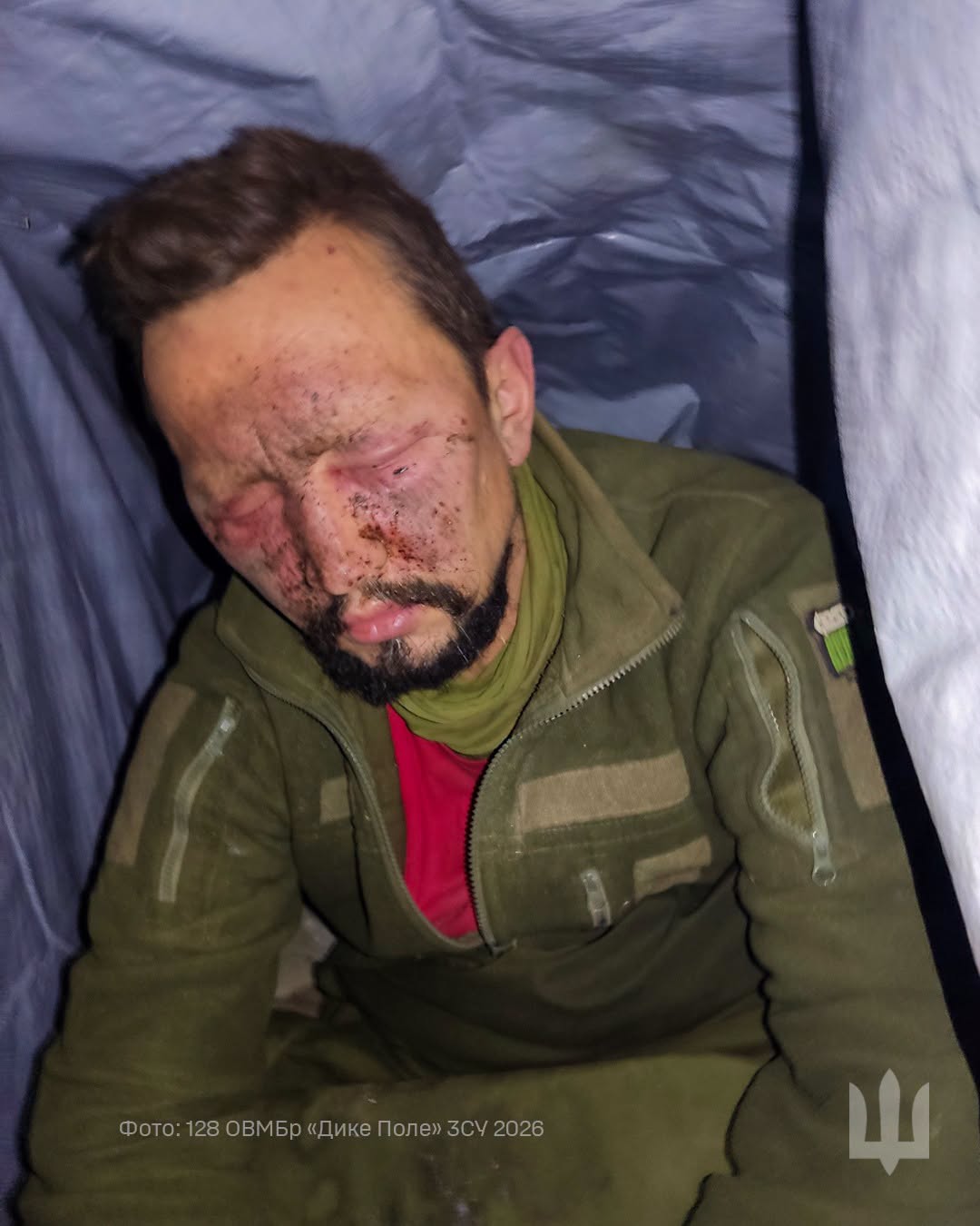 Військовий після важкого удару повністю втратив зір, але ще пів року залишався на позиціях фото 1