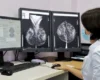 У Києві знизилася смертність від раку молочної залози: офіційні дані
