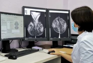 У Києві знизилася смертність від раку молочної залози: офіційні дані
