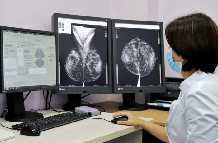 У Києві знизилася смертність від раку молочної залози: офіційні дані